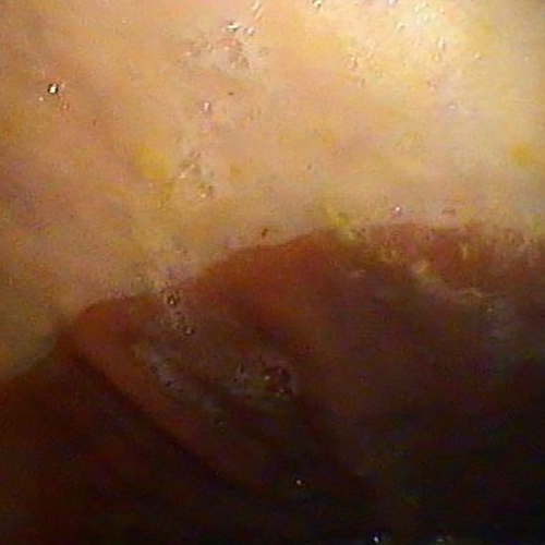 Horse stomach without ulcer.